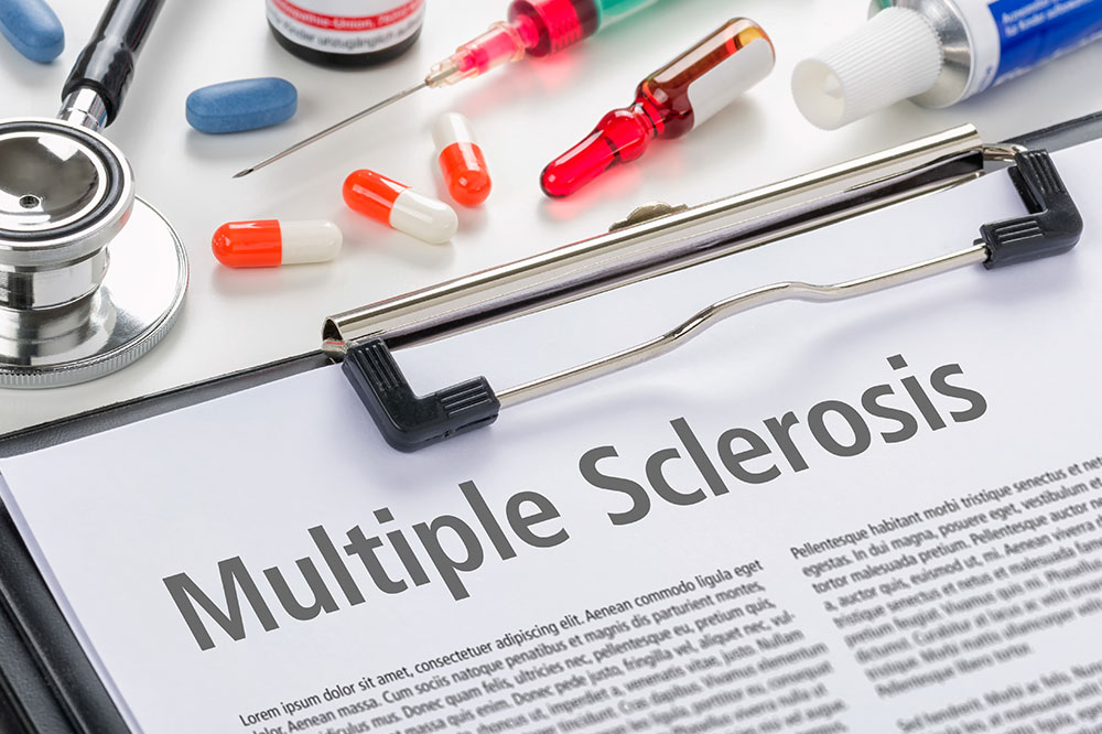 Stages, diagnosis, and prevention of multiple sclerosis