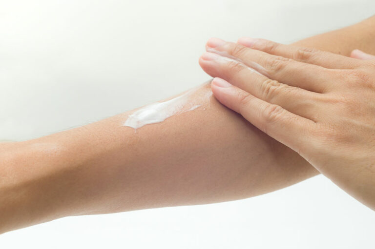 5 best lotions for eczema