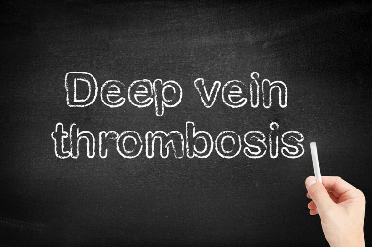 Early signs and risk factors of deep vein thrombosis