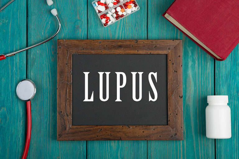 5 triggering factors of lupus to avoid