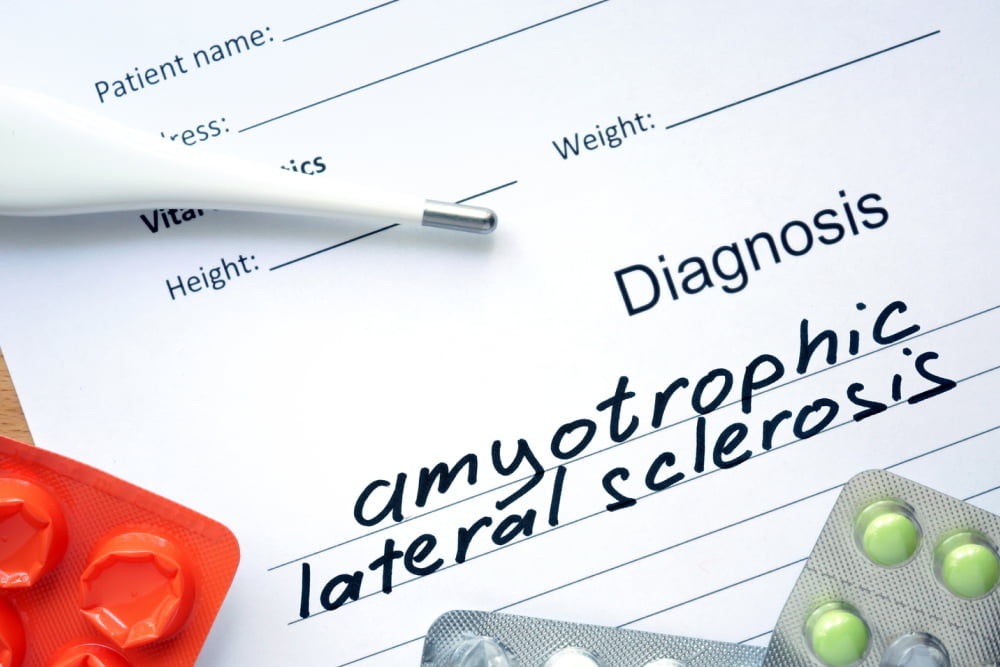 5 early warning signs of amyotrophic lateral sclerosis