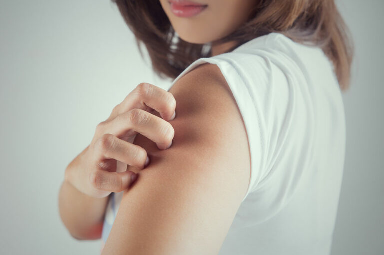 10 common signs of itchy skin